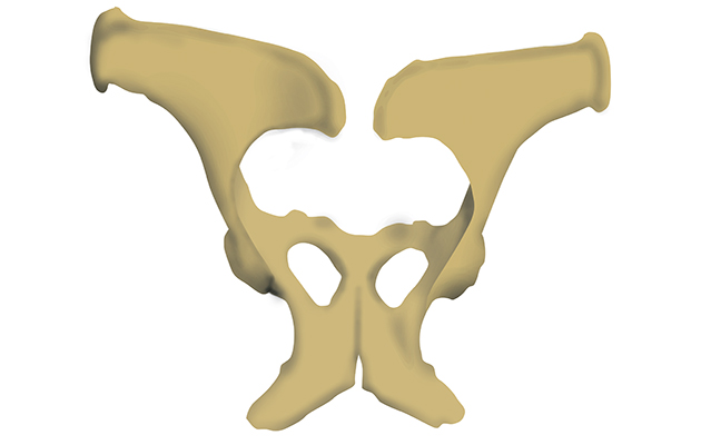 Pelvic fractures: the causes and consequences *H&H VIP* - Horse & Hound