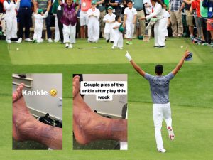 Tony Finau Posts Pictures Of Ankle After Masters