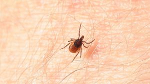 Sheep Tick crawling on human skin