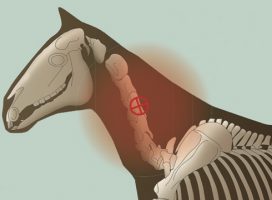 Neck fracture