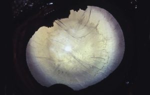 how serious are cataracts in horses