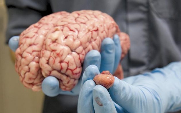 The amazing equine brain *H&H VIP* - Horse & Hound