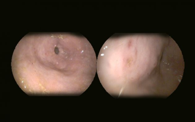 Fiber-beet-added-5-&-6