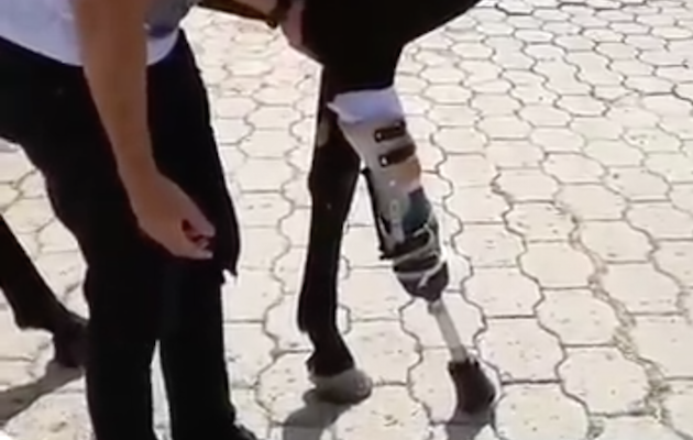 This Is What It's Like To Live With A Prosthetic Leg