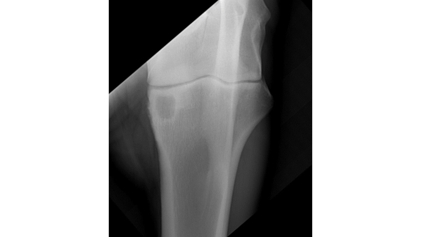 Cysts diagnosing these defects in horses’ bones *H&H VIP* Horse & Hound