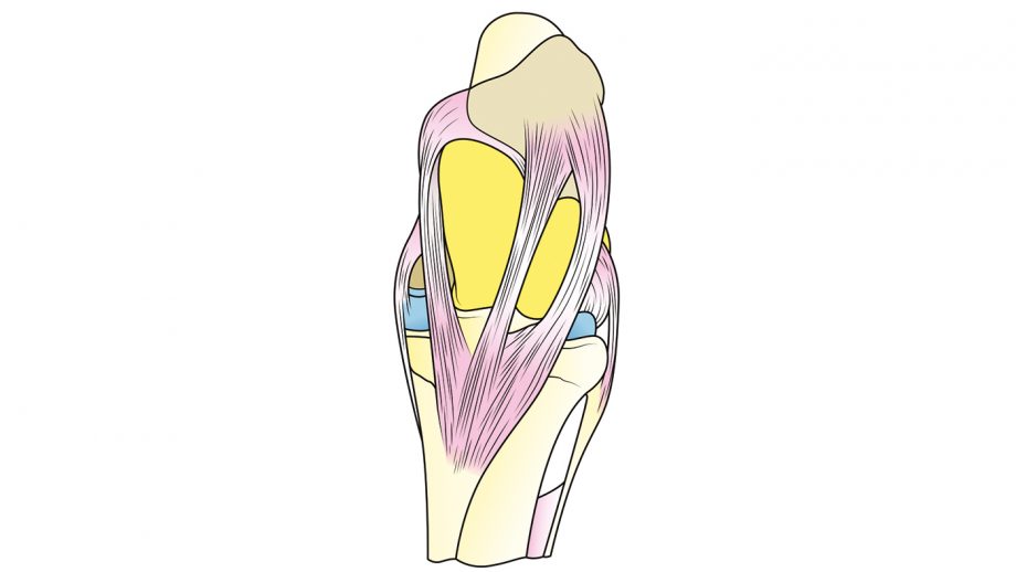 Inside the stifle explaining injuries in horses within this joint *H&H