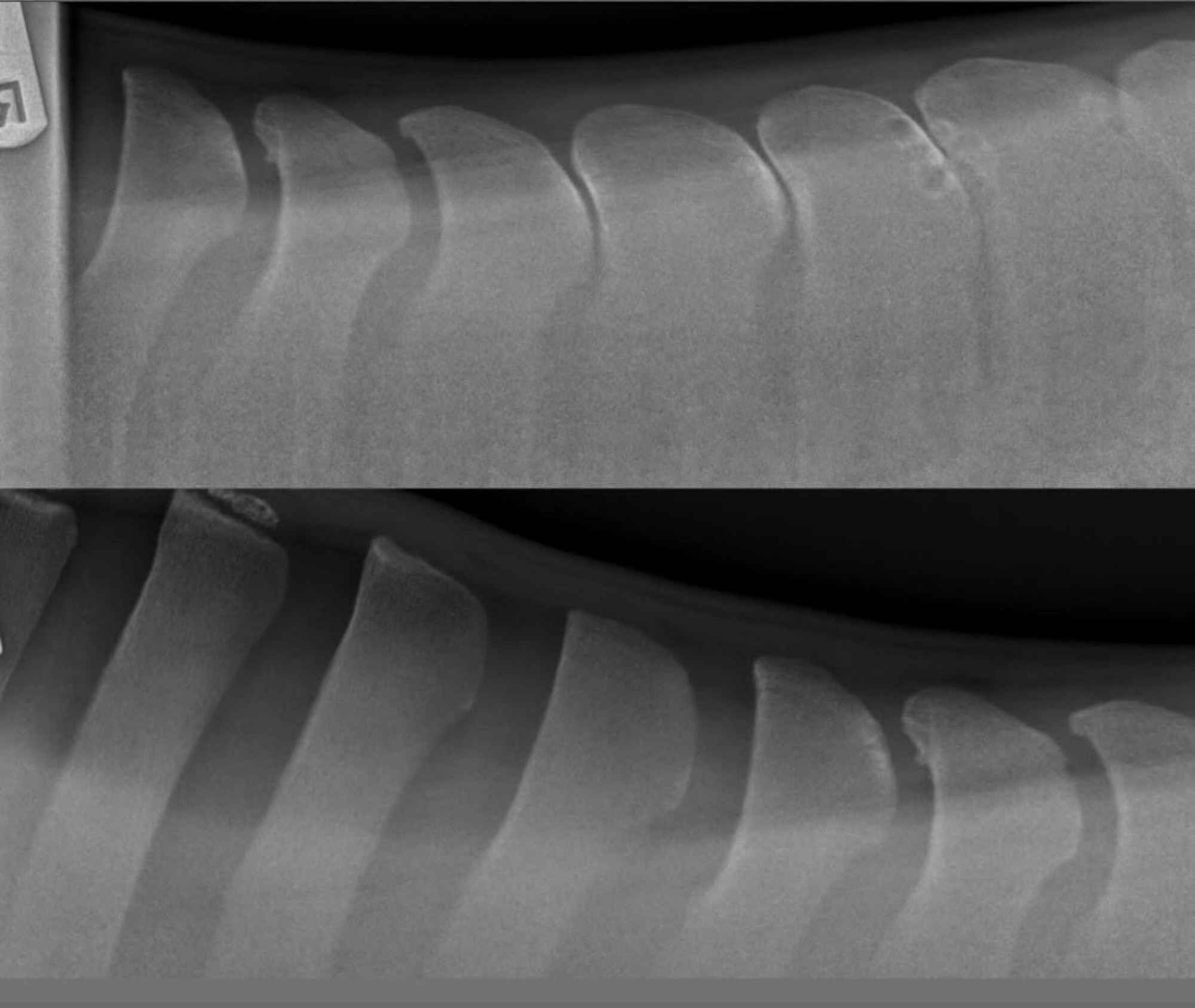 X-ray images of Louie's kissing spines
