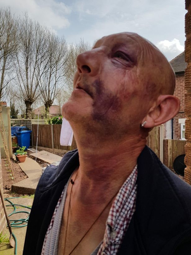 Robert Stevenson was beaten up on the Coventry Canal.