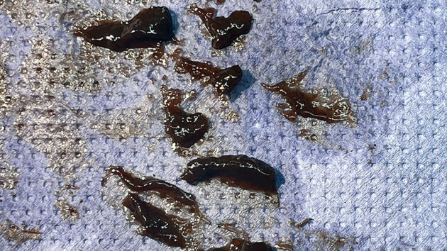 Sludge in marine diesel fuel scrapped on a piece of cloth
