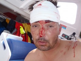 Velux 5 Oceans, Zbigniew Gutkowski head injury