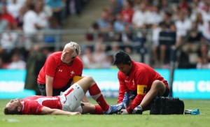Tough break: A broken leg rules Stoddart out of the World Cup