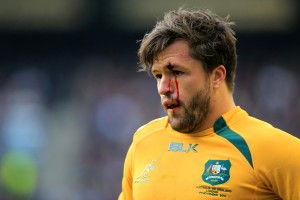 Hurt: A bloodied Wallabies carry on