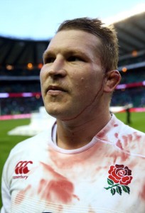 Bloodied but unbowed: Hartley is back in form